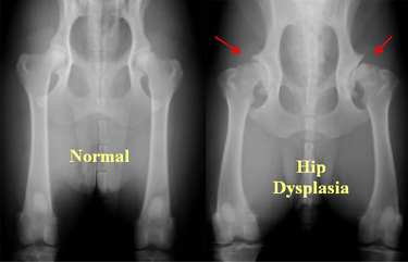 X-ray - Hip Dysplasia